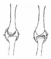 《骨科学》三、断肢再植技术