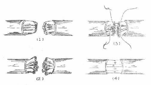 神经束膜缝合示意图
