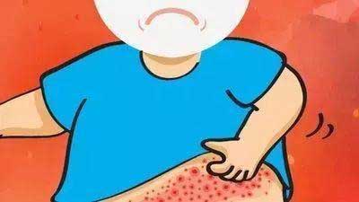 带状疱疹特效方