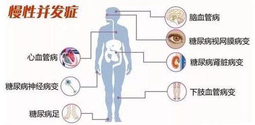 中医治疗糖尿病并发症