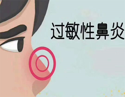 治疗过敏性鼻炎的临床验方-民间偏方