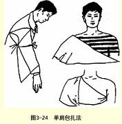 家庭医学百科-自救互救篇：三角巾包扎法