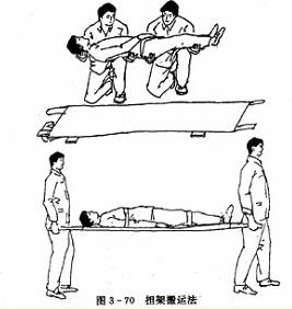 家庭医学百科-自救互救篇：搬运方法