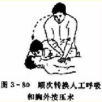 家庭医学百科-自救互救篇：心肺复苏操作程序